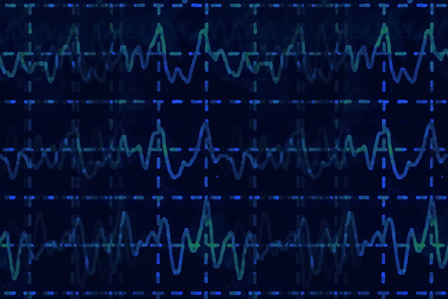 Wave oscillations on a dark background